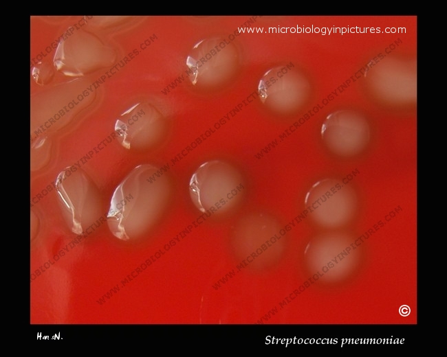 S.pneumoniae colony morphology and hemolysis, M form